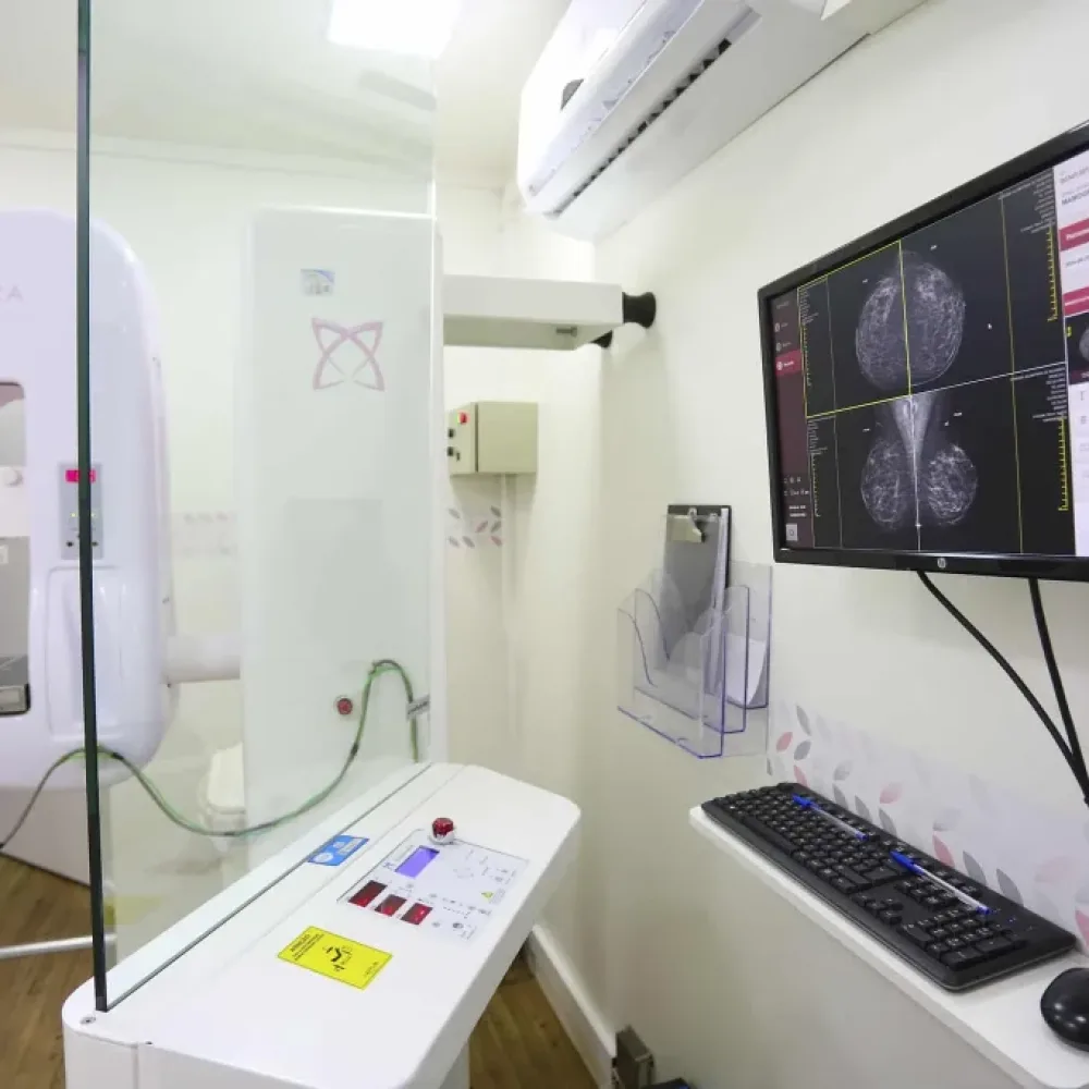 Unidades móveis oferecem mamografias gratuitas para moradoras de cinco cidades paulistas